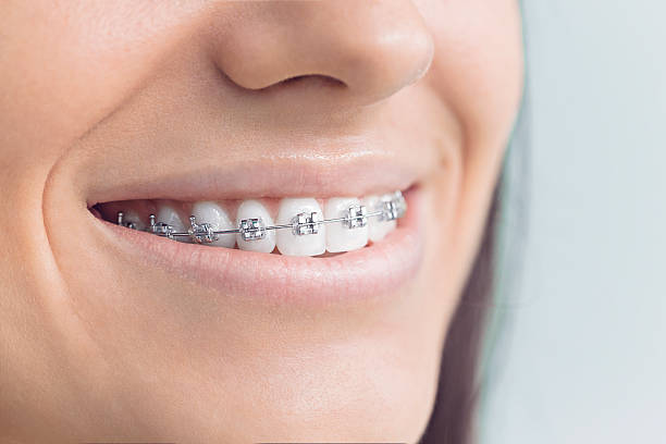 Best Full Mouth Reconstruction  in Kahoka, MO